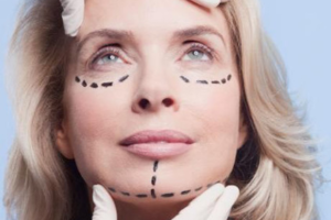 Plastic surgery in Lahore, Plastic surgery Pakistan